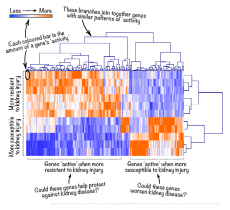 Analysis of the expression of extracellular genes by hierarchical clustering // Reproduced with permission of the American Society of Nephrology, from Randles et al. (2015) Journal of the American Society of Nephrology 26, 3021–3034 // Adaptation by Adam Byron Analysis of the expression of extracellular genes by hierarchical clustering // Reproduced with permission of the American Society of Nephrology, from Randles et al. (2015) Journal of the American Society of Nephrology 26, 3021–3034 // Adaptation by Adam Byron