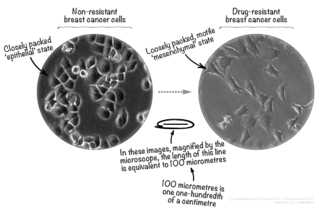 Breast cancer cells, seen under the microscope, changed when they became drug resistant // Image by Adam Byron // Adapted from Creedon et al. (2016) Oncotarget